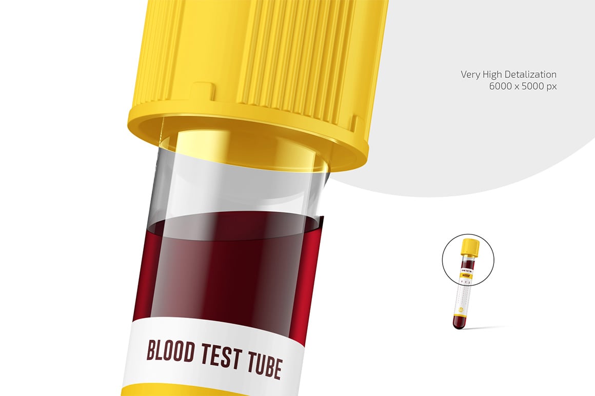 Blood Test Tube Mockup Set